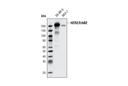 HER2/ErbB2 (D8F12) XP ®  Rabbit mAb