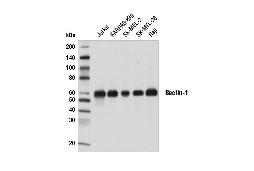 Beclin-1 (2A4) Mouse mAb