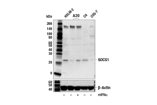 Jak/Stat Pathway Inhibitors Antibody Sampler Kit