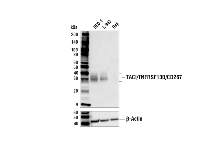 TACI/TNFRSF13B/CD267 (E1D1P) Rabbit mAb