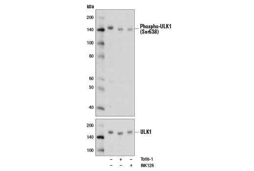 Phospho-ULK1 (Ser638) (D8K9O) Rabbit mAb