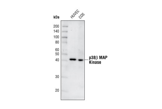 p38 MAPK Isoform Activation Antibody Sampler Kit