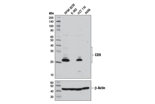 Exosomal Marker Antibody Sampler Kit