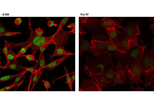 Jak/Stat Pathway Inhibitors Antibody Sampler Kit