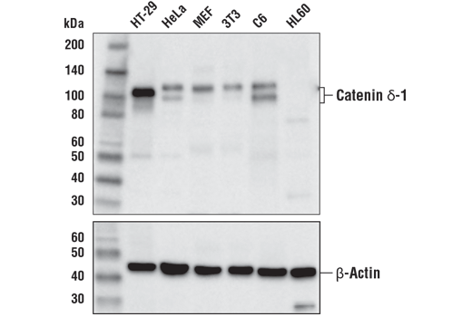 Catenin delta-1 (D7S2M) XP ®  Rabbit mAb