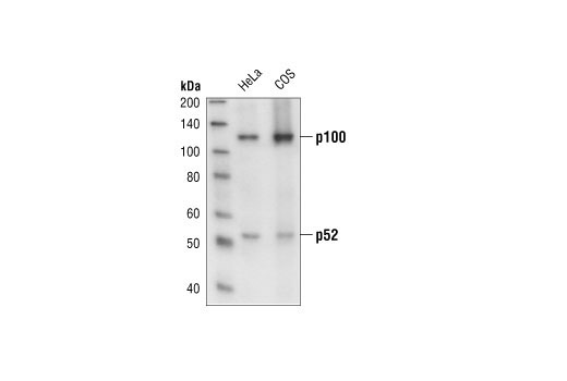 NF-kappaB Family Member Antibody Sampler Kit