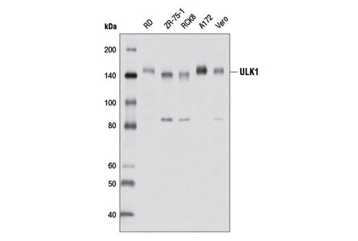 ULK1 (D9D7) Rabbit mAb