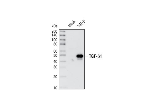 TGF-beta Fibrosis Pathway Antibody Sampler Kit