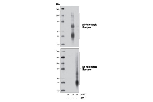 beta1-Adrenergic Receptor Antibody