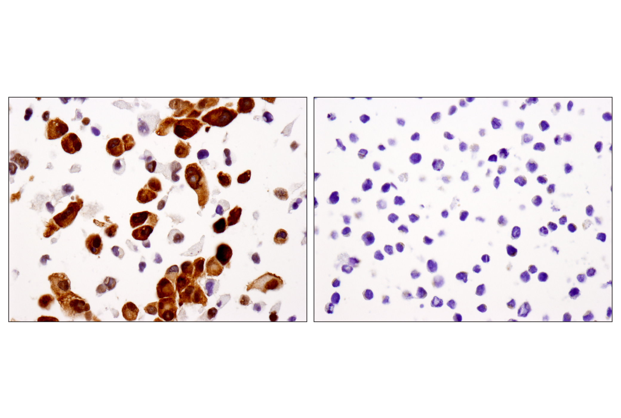 Hippo Pathway: Upstream Signaling Antibody Sampler Kit