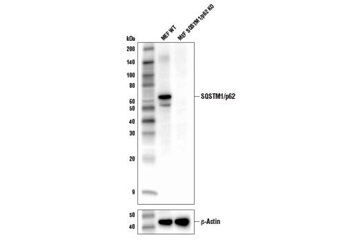 SQSTM1/p62 (D6M5X) Rabbit mAb