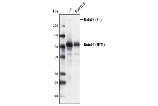 Notch2 (D76A6) XP ®  Rabbit mAb