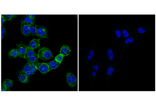 Human TREM2 Activity Antibody Sampler Kit