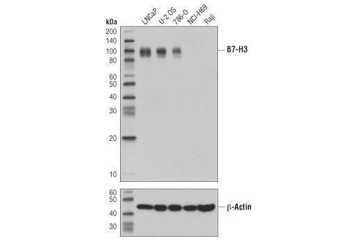 B7-H3 (D9M2L) XP ®  Rabbit mAb