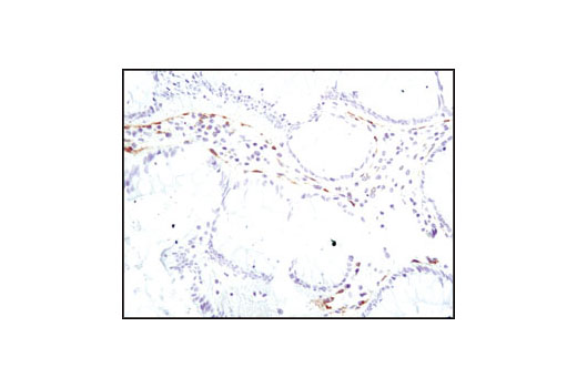 Cancer Associated Fibroblast Marker Antibody Sampler Kit