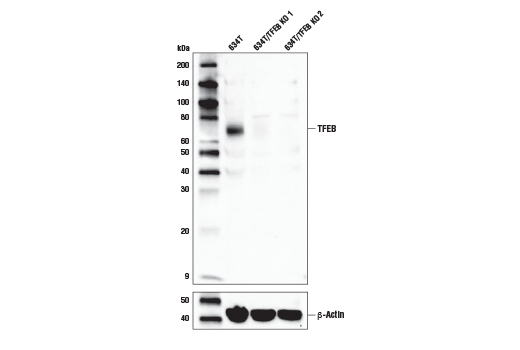 TFEB (D4L2P) Rabbit mAb