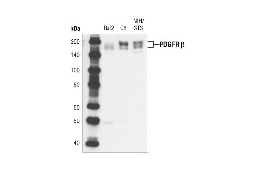 Cancer Associated Fibroblast Marker Antibody Sampler Kit