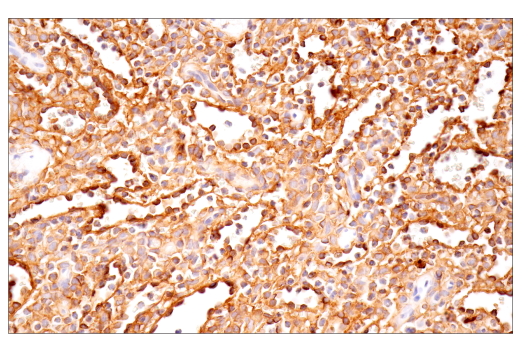 Exosomal Marker Antibody Sampler Kit