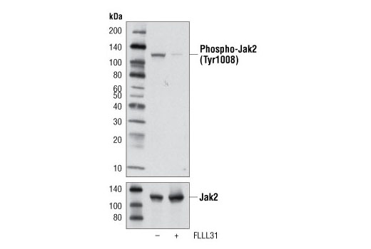 Phospho-Jak Family Antibody Sampler Kit