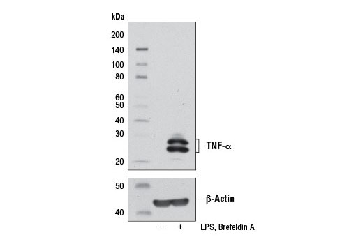 TNF-alpha (D2D4) XP ® Rabbit mAb