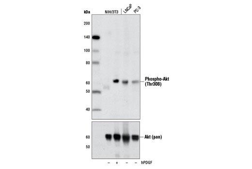 Phospho-Akt Pathway Antibody Sampler Kit