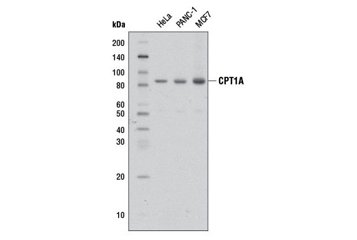 CPT1A (D3B3) Rabbit mAb