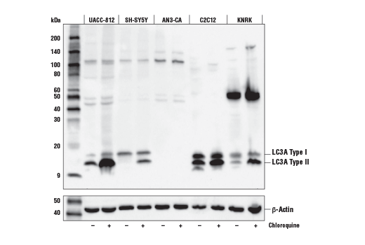 LC3A (E5C9B) Rabbit mAb