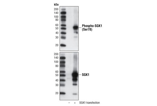 Phospho-SGK1 (Ser78) (D36D11) Rabbit mAb