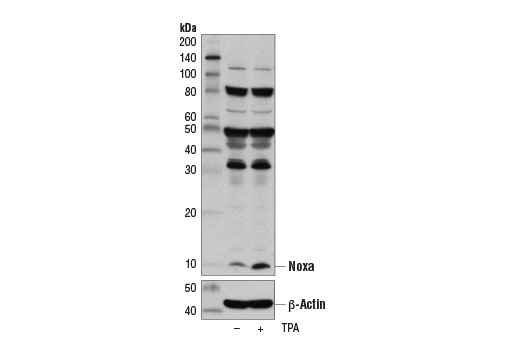 Pro-Apoptosis Bcl-2 Family Antibody Sampler Kit II