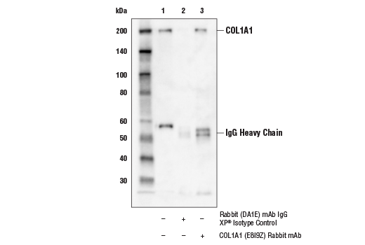 TGF-beta Fibrosis Pathway Antibody Sampler Kit