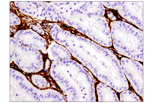 Cancer Associated Fibroblast Marker Antibody Sampler Kit