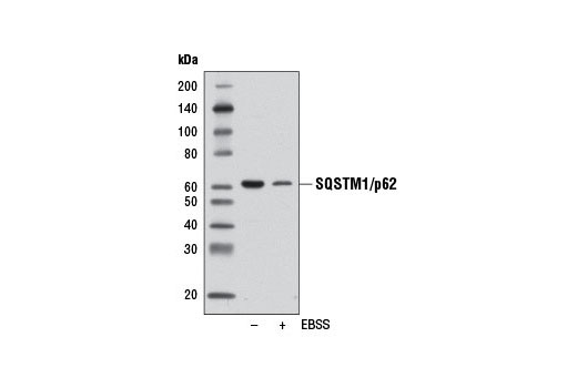 SQSTM1/p62 (D5E2) Rabbit mAb