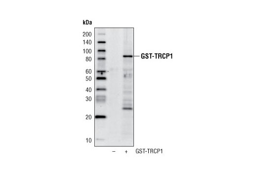 GST-Tag (91G1) Rabbit mAb (HRP Conjugate)