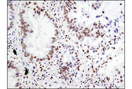Notch Receptor Interaction Antibody Sampler Kit