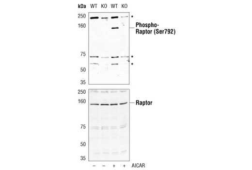 ULK1 Antibody Sampler Kit