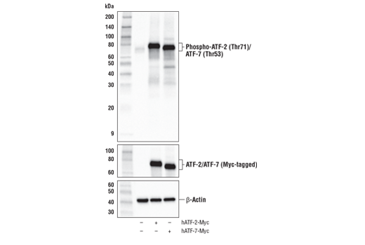 Phospho-p38 MAPK Pathway Antibody Sampler Kit