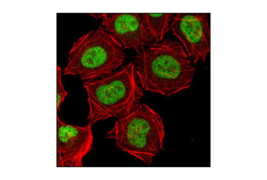 CDK Antibody Sampler Kit