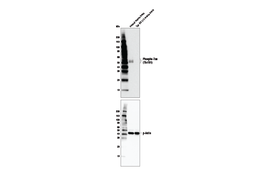 Phospho-Tau (Thr181) (D9F4G) Rabbit mAb