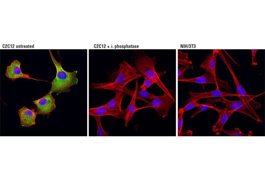 Phospho-p38 MAPK Pathway Antibody Sampler Kit