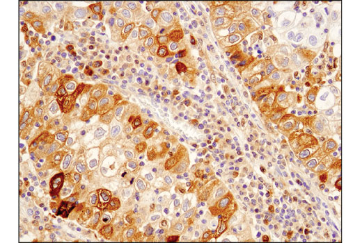 Human Reactive Cell Death and Autophagy Antibody Sampler Kit