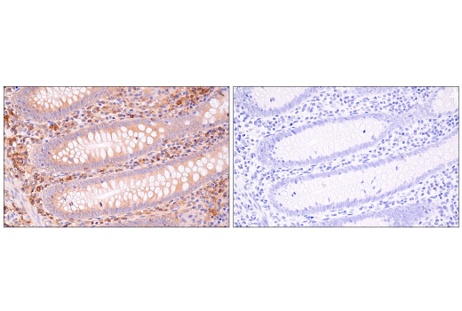 NF-kappaB Family Member Antibody Sampler Kit