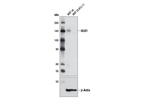 ULK1 (D8H5) Rabbit mAb