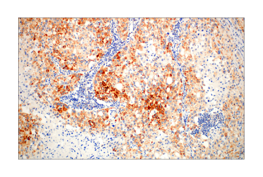 Pro-Apoptosis Bcl-2 Family Antibody Sampler Kit