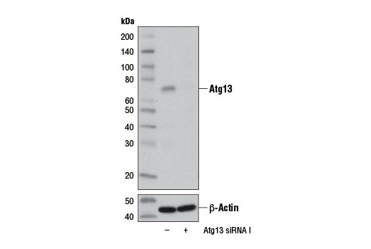 Atg13 (D4P1K) Rabbit mAb
