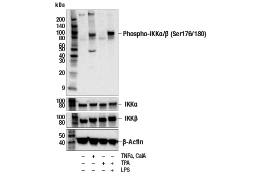 NF-kappaB Pathway Antibody Sampler Kit