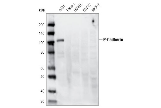 Cadherin-Catenin Antibody Sampler Kit