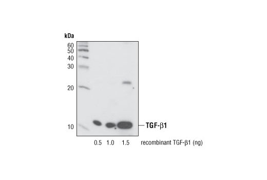TGF-beta Fibrosis Pathway Antibody Sampler Kit