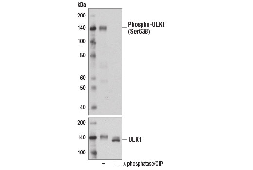 Phospho-ULK1 (Ser638) (D8K9O) Rabbit mAb