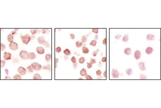 Notch Activated Targets Antibody Sampler Kit