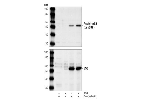 p53 Antibody Sampler Kit